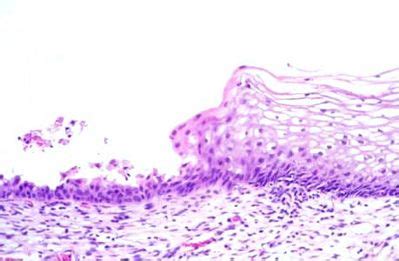 Uterus Histology - Cervix - histology slide