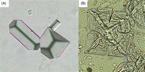 Differential identification of urine crystals with morphologic characteristics and solubility ...