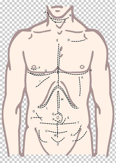 Surgical Incision Surgery Xiphoid Process McBurney's Point Median ...