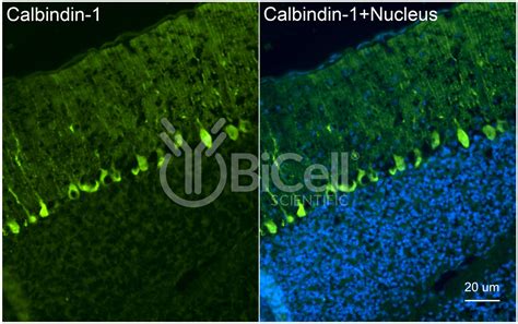 Calbindin-1 (CALB1 or Calbindin D-28K) antibody - BiCell Scientific®