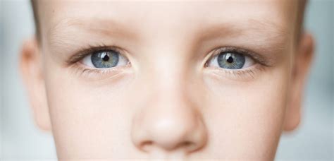 Pinpoint Pupils: Symptoms, Causes & Treatment