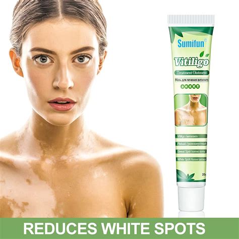 Buy Sumifun Vitiligo Cream, Vitiligo Care Cream, Pigmentation regulating & Improve Skin ...