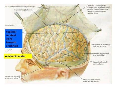 Pictures Of Arachnoid Mater