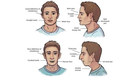 Mewing Before and After is to have the tongue pressed evenly on the palate over its entire area ...