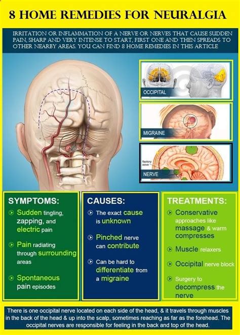 8 Home Remedies for Neuralgia - #Neuralgia is known as the irritation ...