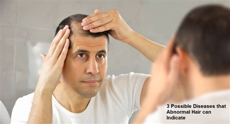 3 Possible Diseases that Abnormal Hair can Indicate - Lifefitnesstricks