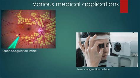 The use of lasers in medicine - online presentation