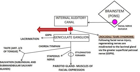 Crocodile Tears Syndrome - StatPearls - NCBI Bookshelf