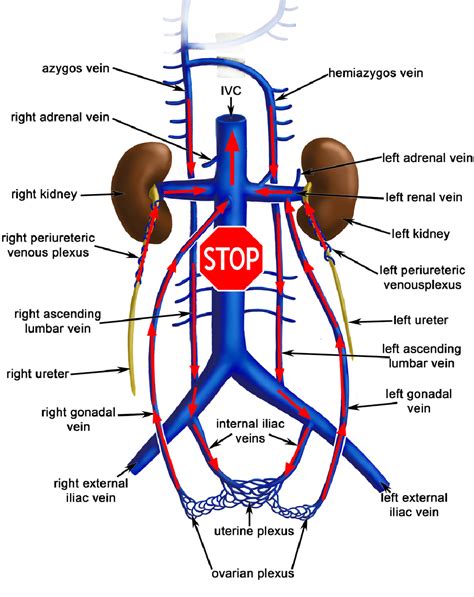 Figure 1 from Congenital absence of inferior vena cava. | Semantic Scholar | Vena cava, Vena ...