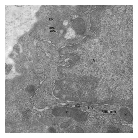 Autophagy under transmission electron microscope (TEM). (b ...