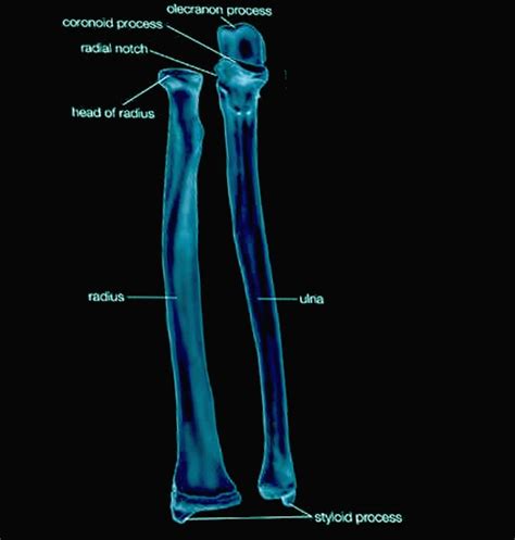 [Figure, Radius & ulna Image courtesy Dr Chaigasame] - StatPearls - NCBI Bookshelf