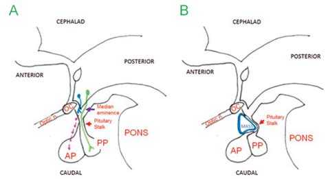 Pituitary Stalk Lesion Clinical Features - mapametawan