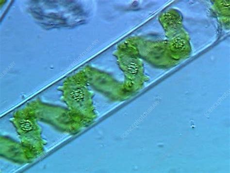 Spirogyra green algae - Stock Video Clip - K002/1787 - Science Photo Library