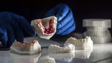 Major Advantages Of Adopting Dental 3d Printing Platform - Terrible Aanalogies