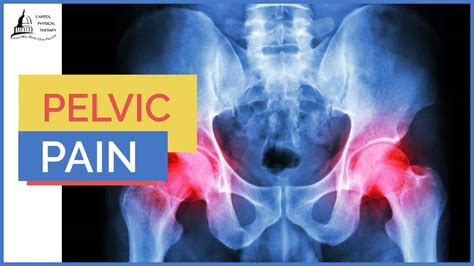 How Physical Therapy Can Help Treat Pelvic Pain | Capitol Physical ...