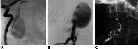 Case 7: 5-year-old boy with progressive tetraparesis. A,... | Download ...