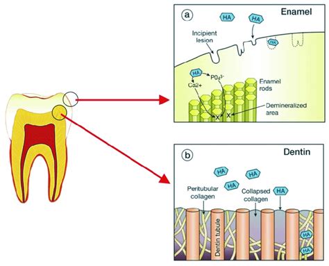 The mechanism of action of HA on the remineralisation of enamel (a) and ...