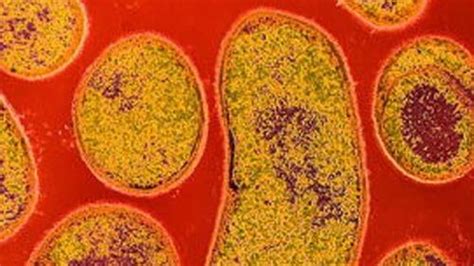 Ohio botulism outbreak kills 1, hospitalizes 20