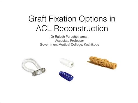 Acl graft fixation options