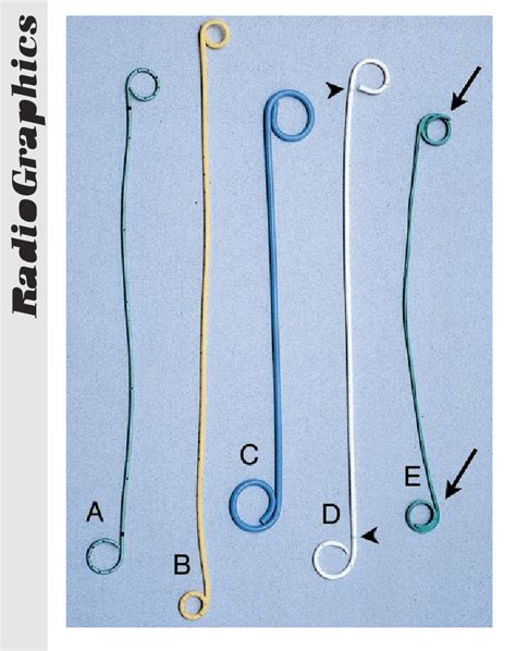 Table 1 from Complications of ureteral stent placement. | Semantic Scholar