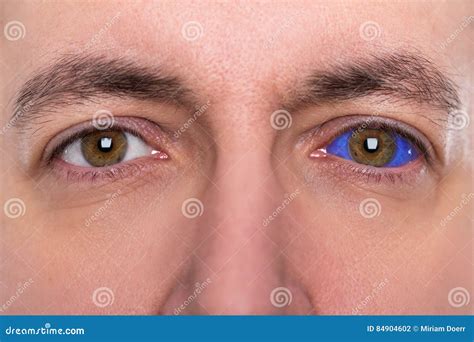 Close Up, Man with a Blue Eyeball Tattoo Stock Photo - Image of modification, leather: 84904602