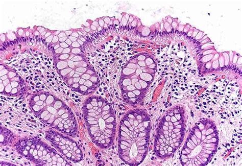 Goblet Cells | Definition, Functions, Mucus Secretion and Diseases