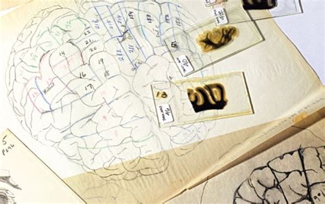 The Quest for Genius in Einstein's Brain - Scientific American