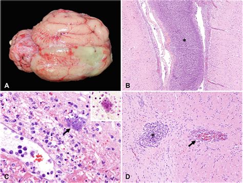 Pasteurella Multocida Human Infection