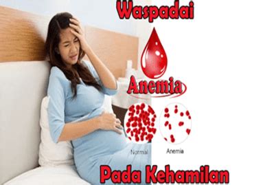 Anemia pada ibu hamil