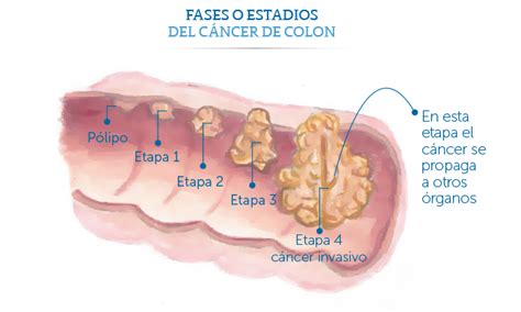 Médica Sur: Fases