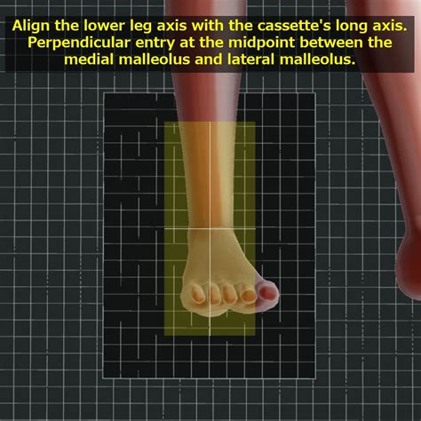 Ankle AP view, Ankle mortise view｜Tools for RadTech