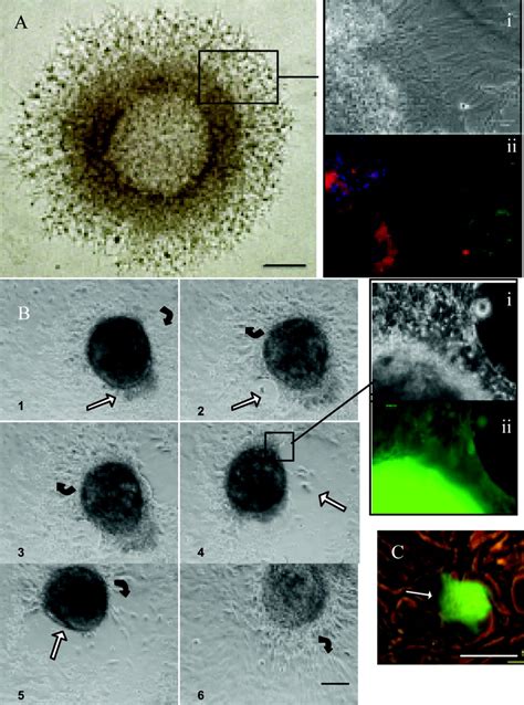 Cytotrophoblast stem (CTBS) spheroid trophoblast bodies (TBs) in ...