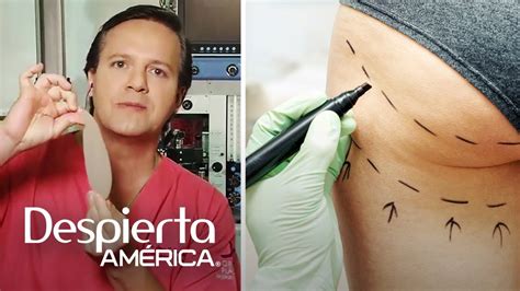 Mitos y realidades de los implantes de glúteo - YouTube