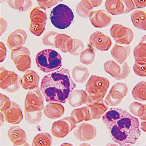 StainRITE® Wright-Giemsa Stain Solution