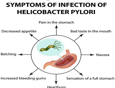 Helicobacter Pylori H Pylori Infection Symptoms And Causes Mayo | My XXX Hot Girl