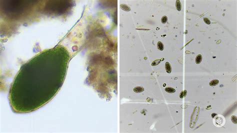 Algae Corner Fan Letter: How Come I Keep Getting Algae? | SePRO Corporation