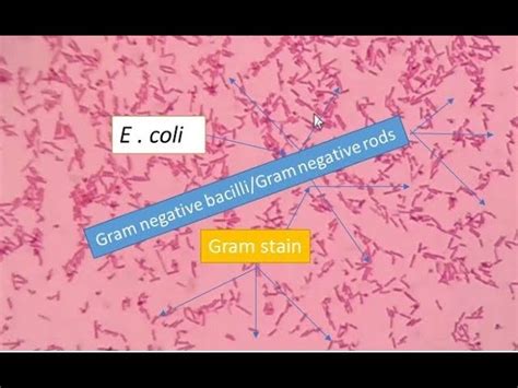 Gram Negative Rods E Coli