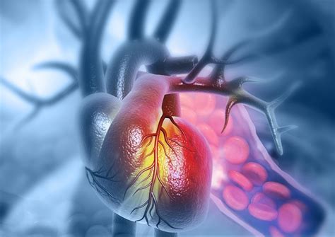 Coarctation of the Aorta Surgery