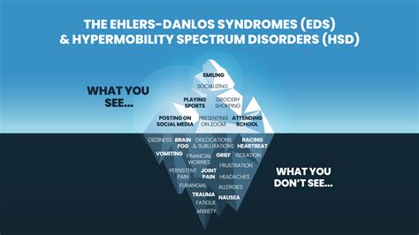 The iceberg model of Ehlers-Danlos Syndromes EDS and Hypermobility spectrum disorder HDS concept ...