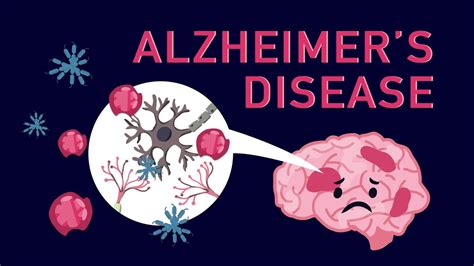 What is Alzheimer’s Disease? - YouTube