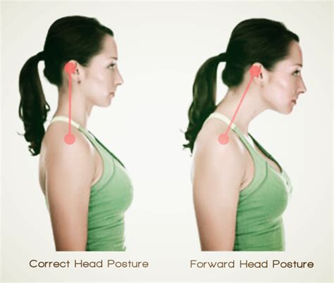 What Are Some Ways to Improve Your Posture? (Neck Pain Support Blog)