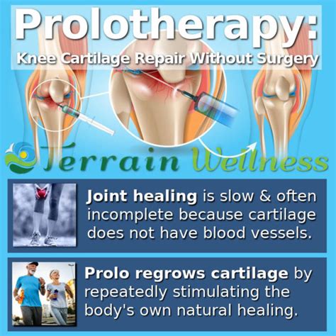 Knee cartilage repair without surgery