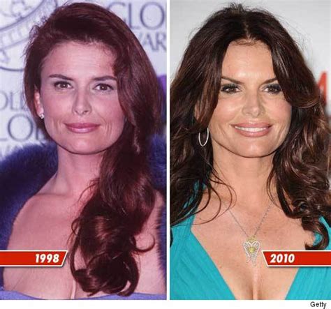 Roma Downey Plastic Surgery Before And After Photos