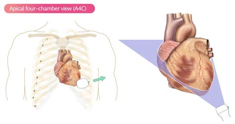 Standard Transthoracic Echocardiogram: Complete Imaging Protocol – ECG ...