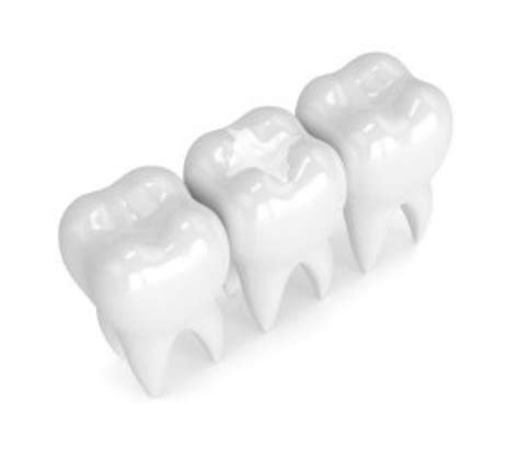 Dental Sealants Somerset, NJ | Destination Dental Care