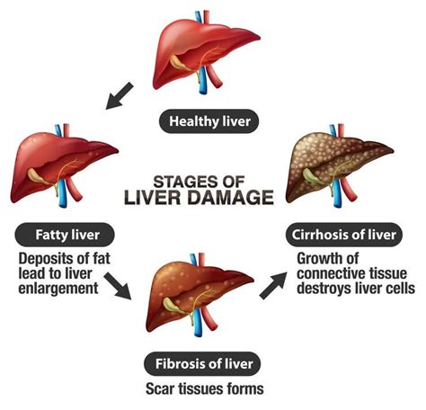 “Holistic Ayurvedic Approach to Kidney Cysts: Natural Treatment Methods” - sandhya medicity - Medium