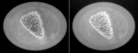 X-Ray Phase-Contrast (XPC) Imaging and Tomography – Computational Imaging Science Laboratory