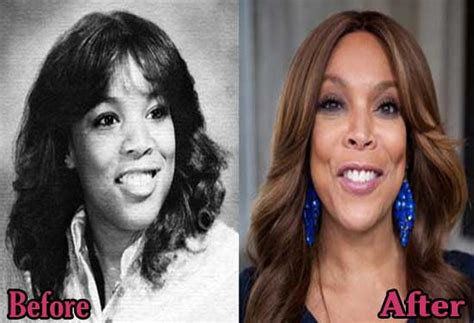 Wendy Williams Plastic Surgery Before and After Photos | Top Piercings