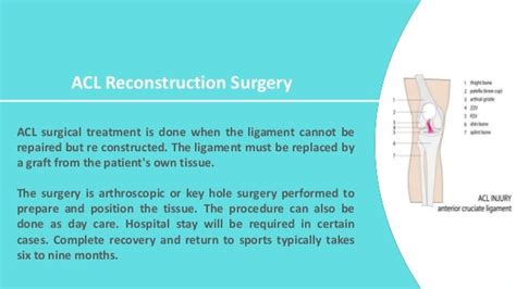 ACL surgery in India | ACL surgery cost in India