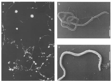 Spheroplasting culture of Borrelia burgdorferi cultivated from a Lyme ...